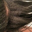 transition capillaire